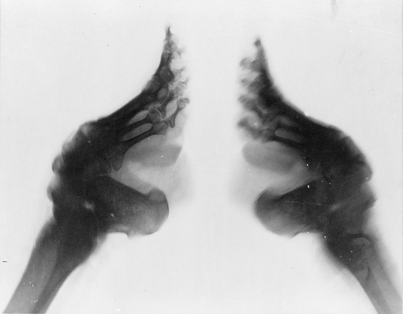 Illustration for article titled El espeluznante proceso chino de los pies de loto: la momificación de las extremidades para encontrar pareja